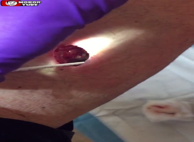 Video :It's not a nice sight when his best friend unintentionally shoots him in the thigh